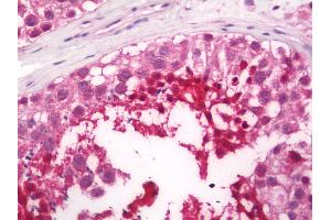 anti-Phosducin-Like 2 (PDCL2) (AA 5-237) antibody