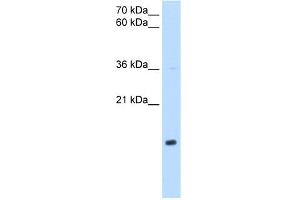 WB Suggested Anti-NDUFB5 Antibody Titration:  0. (NDUFB5 anticorps  (Middle Region))