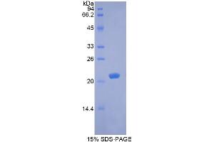 SDS-PAGE analysis of Rabbit BDNF Protein. (BDNF Protéine)
