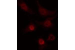 ABIN6274267 staining COLO205 cells by IF/ICC. (CLK2 anticorps  (N-Term))