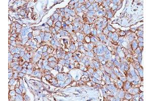 Image no. 1 for anti-CD44 Standard (CD44s) antibody (ABIN6151476) (CD44 Standard anticorps)