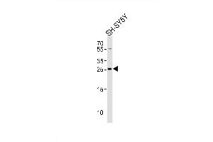 Western blot analysis of lysate from SH-SY5Y cell line, using ZDHHC21 Antibody (N-term)( (ABIN651365 and ABIN2840203)). (ZDHHC21 anticorps  (N-Term))
