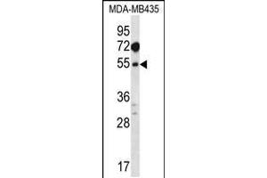 Western blot analysis in MDA-MB435 cell line lysates (35ug/lane). (MAT1A anticorps  (N-Term))
