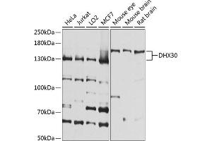 Western blot analysis of extracts of various cell lines, using DHX30 antibody (ABIN6130264, ABIN6139607, ABIN6139608 and ABIN6224677) at 1:1000 dilution. (DHX30 anticorps  (AA 906-1155))