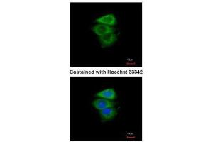 ICC/IF Image Immunofluorescence analysis of paraformaldehyde-fixed A549, using eIF2 alpha, antibody at 1:200 dilution. (EIF2A anticorps  (Center))