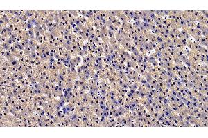 #VALUE! (Urocortin 2 anticorps  (AA 20-112))