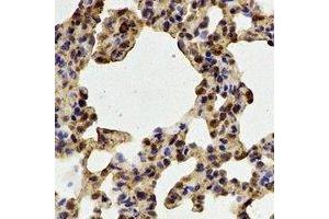 Immunohistochemical analysis of PADI4 staining in rat lung formalin fixed paraffin embedded tissue section.