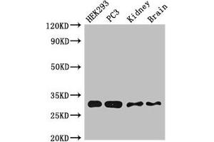 Western Blot Positive WB detected in:HEK293 whole cell lysate,PC-3 whole cell lysate,Mouse kidney tissue,Mouse brain tissue All lanes:CBR1 antibody at 2. (CBR1 anticorps  (AA 176-268))