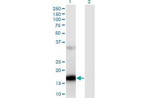 Western Blot analysis of ZCCHC13 expression in transfected 293T cell line by ZCCHC13 monoclonal antibody (M02), clone 4G11.