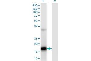 Western Blot analysis of ZCCHC13 expression in transfected 293T cell line by ZCCHC13 monoclonal antibody (M02), clone 4G11. (ZCCHC13 anticorps  (AA 1-166))