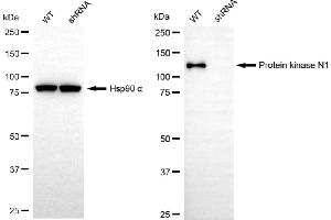 Western blotting analysis using protein kinase N1 antibody (ABIN7800005).