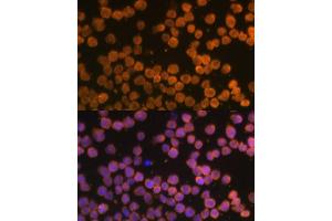 Immunofluorescence analysis of THP-1 cells using TNFRSF10A Polyclonal Antibody (ABIN6127583, ABIN6149301, ABIN6149303 and ABIN6216204) at dilution of 1:100 (40x lens). (TNFRSF10A anticorps  (AA 269-468))