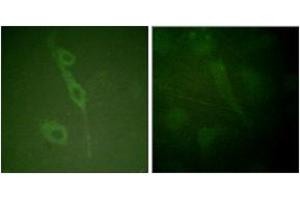 Immunofluorescence analysis of HuvEc cells, using IL-7R/CD127 (Phospho-Tyr449) Antibody. (IL7R anticorps  (pTyr449))