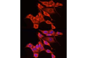 Immunofluorescence analysis of NIH/3T3 cells using RPS18 Rabbit pAb (ABIN6128660, ABIN6147205, ABIN6147206 and ABIN6215379) at dilution of 1:250 (40x lens).