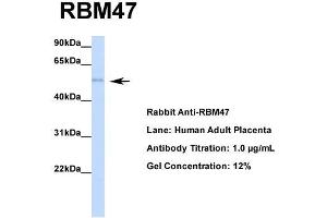 Host: Rabbit  Target Name: RBM47  Sample Tissue: Human Adult Placenta  Antibody Dilution: 1. (RBM47 anticorps  (Middle Region))