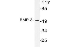 Western blot (WB) analyzes of BMP-3 antibody in extracts from HeLa cells. (BMP3 anticorps)