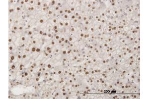 Immunoperoxidase of monoclonal antibody to SMAD6 on formalin-fixed paraffin-embedded human liver.
