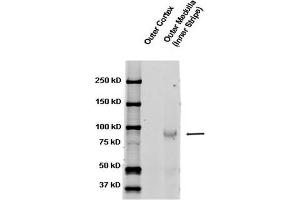Western blot analysis of Rat kidney tissue lysates showing detection of ENaC protein using Rabbit Anti-ENaC Polyclonal Antibody . (SCNN1A anticorps  (AA 617-638) (FITC))