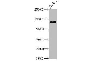 Western Blot Positive WB detected in: Jurkat whole cell lysate All lanes: SREBF1 antibody at 5. (SREBF1 anticorps  (AA 38-201))