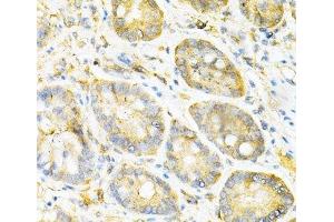 Immunohistochemistry of paraffin-embedded Mouse stomach using SULT2A1 Polyclonal Antibody at dilution of 1:200 (40x lens).