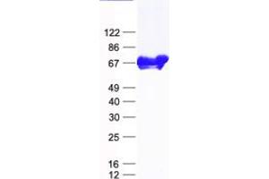Validation with Western Blot