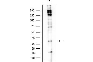 anti-alpha-1,4-N-Acetylglucosaminyltransferase (A4GNT) (C-Term) antibody