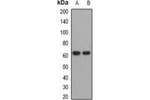 Western blot analysis of PACAP-R1 expression in Hela (A), SHSY5Y (B) whole cell lysates. (ADCYAP1R1 anticorps)