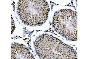 IHC analysis of MBNL1 using anti-MBNL1 antibody (ABIN7602608). (MBNL1 anticorps  (AA 89-388))