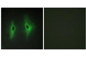Immunofluorescence analysis of HeLa cells, using DGKH antibody. (DGKH anticorps  (Internal Region))