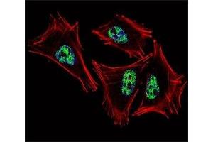 Fluorescent confocal image of A2058 cell stained with PROX1 antibody at 1:25.