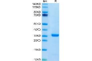 Human FOLR4/Juno on Tris-Bis PAGE under reduced condition. (Folate Receptor 4 Protein (AA 20-228) (His tag))