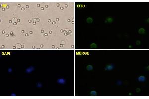 PC-3 MM2 cells were stained with CTNNB1-FITC labeled monoclonal antibody (Green).