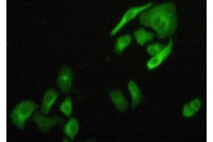 Figure:FITC staining on IHC-P Simple: Hela cells (FLNB anticorps  (AA 1175-1457))