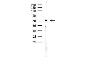 Western blot analysis of lysates from Rat brain, using Phospho-c-Jun (Ser73) Antibody at 1/1000 dilution.