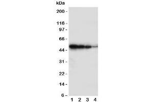 Western blot testing of BMPR1B antbody;  Lane 1: Recombinant human protein 10ng;  2: 5ng;  3: 2.