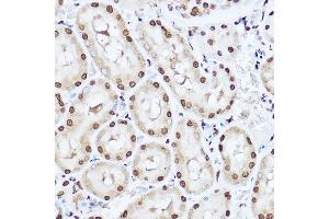 Immunohistochemistry of paraffin-embedded rat kidney using SOD1 Rabbit pAb (ABIN3020854, ABIN3020855, ABIN3020856 and ABIN6213758) at dilution of 1:150 (40x lens). (SOD1 anticorps  (AA 1-154))