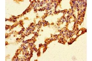 Immunohistochemistry of paraffin-embedded human lung tissue using ABIN7165390 at dilution of 1:100 (FAM131A anticorps  (AA 1-281))