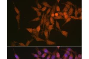 Immunofluorescence analysis of HeLa cells using PSMB6 Polyclonal Antibody at dilution of 1:100 (40x lens).
