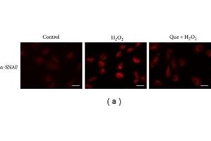 Comprehensive immunofluorescence images and immunoblotting analysis of the differentially expressed proteins identified by MALDI-TOF MS.
