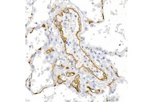 Immunohistochemistry of paraffin-embedded human lung using CD146/MCAM Rabbit pAb (ABIN6127568, ABIN6143621, ABIN6143622 and ABIN6218100) at dilution of 1:25 (40x lens). (MCAM anticorps  (AA 447-646))