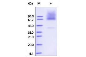 Human Glypican 3, His Tag on SDS-PAGE under reducing (R) condition.