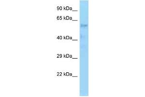 WB Suggested Anti-ZNF20 Antibody Titration: 1. (ZNF20 anticorps  (C-Term))