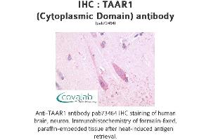 Image no. 1 for anti-Trace Amine Associated Receptor 1 (TAAR1) (3rd Cytoplasmic Domain) antibody (ABIN1739854) (TAAR1 anticorps  (3rd Cytoplasmic Domain))