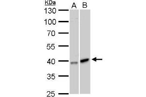 WB Image GALK1 antibody detects GALK1 protein by Western blot analysis. (GALK1 anticorps)