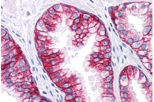 Human Prostate: Formalin-Fixed, Paraffin-Embedded (FFPE) (EpCAM anticorps)