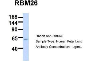 Host:  Rabbit  Target Name:  RBM26  Sample Type:  Human Fetal Lung  Antibody Dilution:  1. (RBM26 anticorps  (Middle Region))