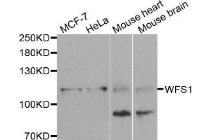 Western blot analysis of extracts of various cells, using WFS1 antibody. (WFS1 anticorps)