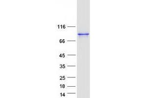 Validation with Western Blot