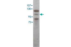 Western blot using Stat5a polyclonal antibody  shows detection of Stat5a protein in HeLa cell extract (arrowhead).