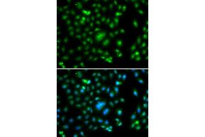 Immunofluorescence analysis of A549 cells using ELF5 antibody. (ELF5 anticorps)